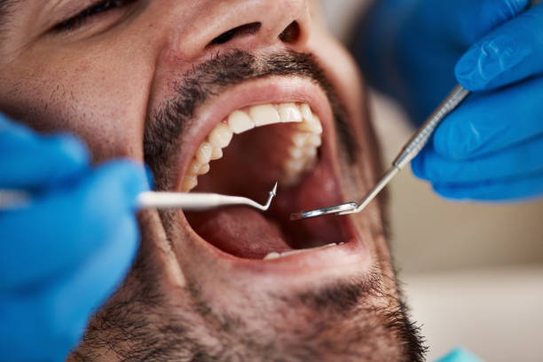 Best Emergency Dental Care for Broken or Chipped Teeth in Mion, AR