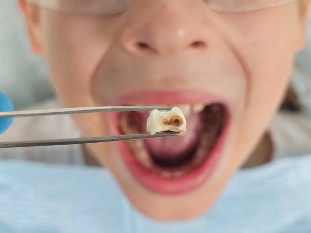 Best After-Hours Dental Trauma Care in Mion, AR