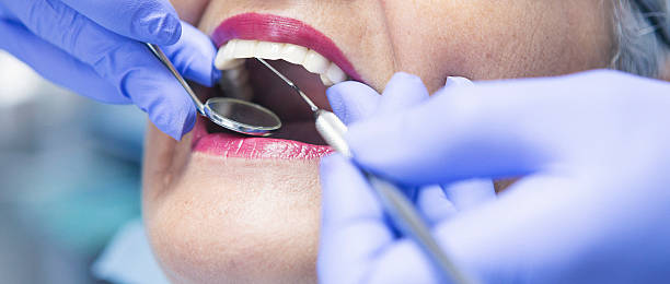 Best Emergency Root Canal Treatment in Mion, AR